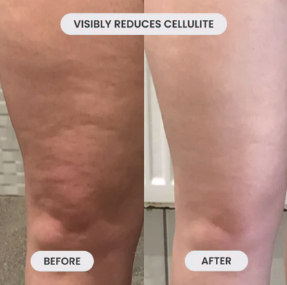 CelluFade Pro - Noyré