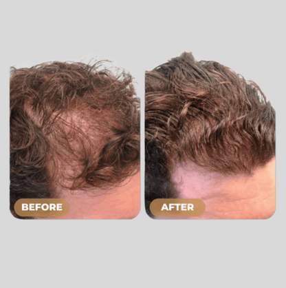 Root Activator Shampoo - Noyré