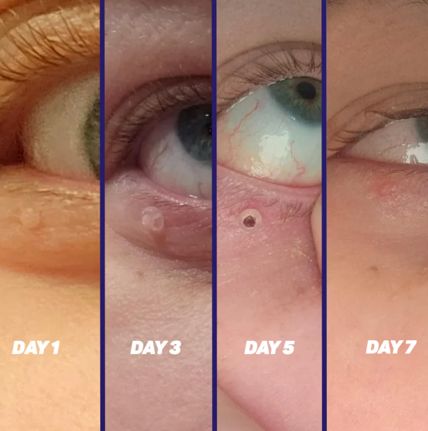 Noyré Tagbud - Noyré