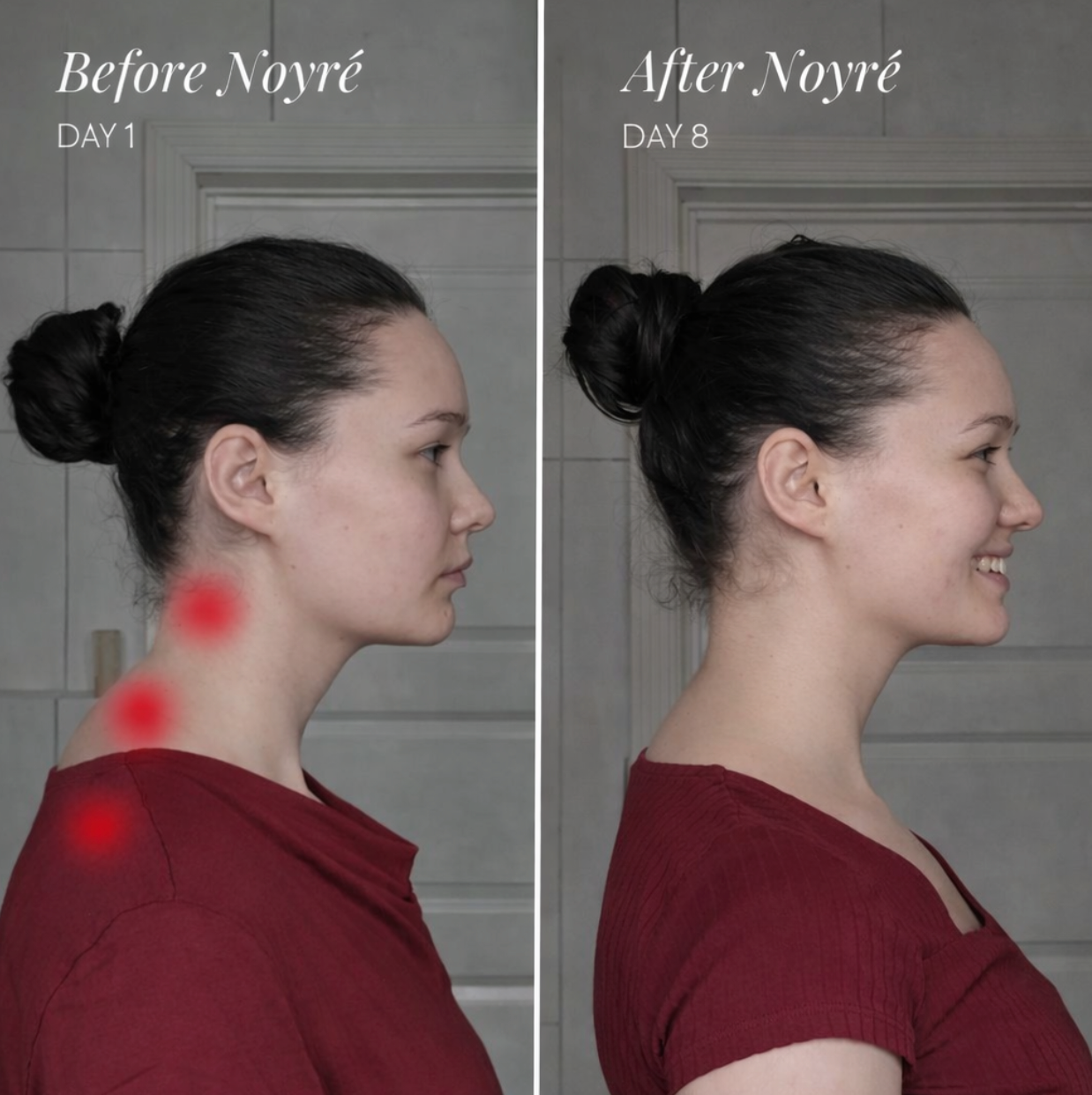 Noyre NeckRelief - Noyré